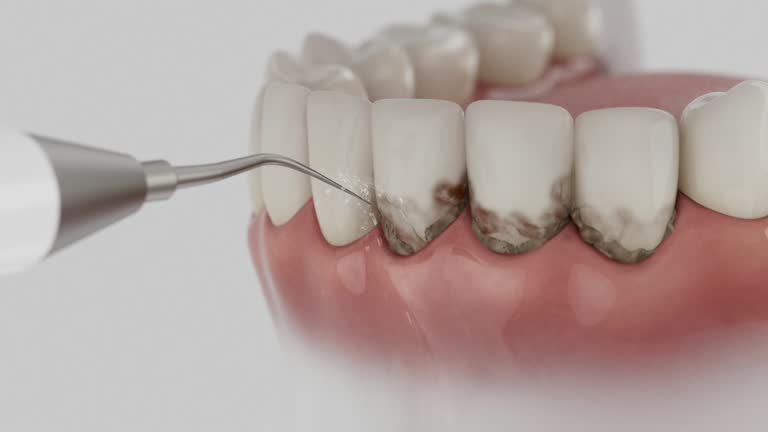Trusted Teeth Cleaning And Checkup service in Downs, IL - Dentist Open Now